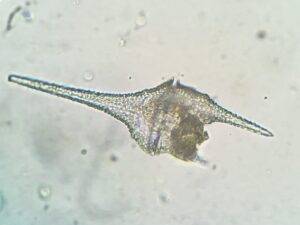 Microalga invasora pode prejudicar tratamento de água e a sobrevivência da fauna aquática